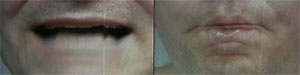 mouths